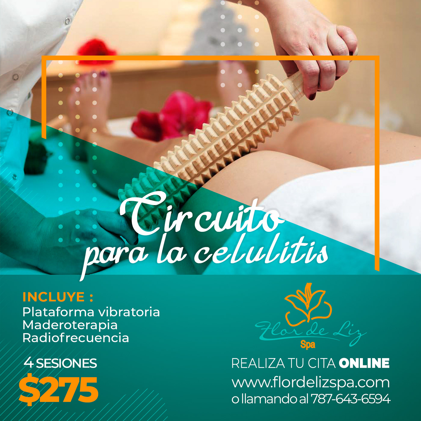 Gráfico Redes Sociales Flor de Liz Spa - Depilación